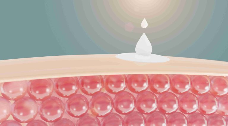 ciri ciri skin barrier rusak